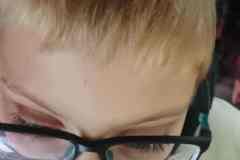 chata-przychody-UZ-16